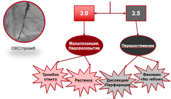 stentys